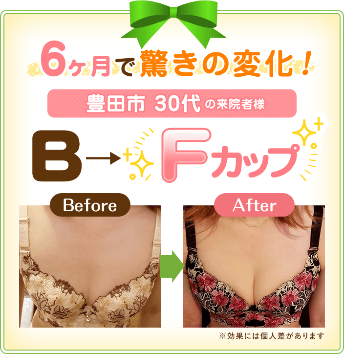 バストアップ - 豊明市の整体 | おひさまメナジー治療院